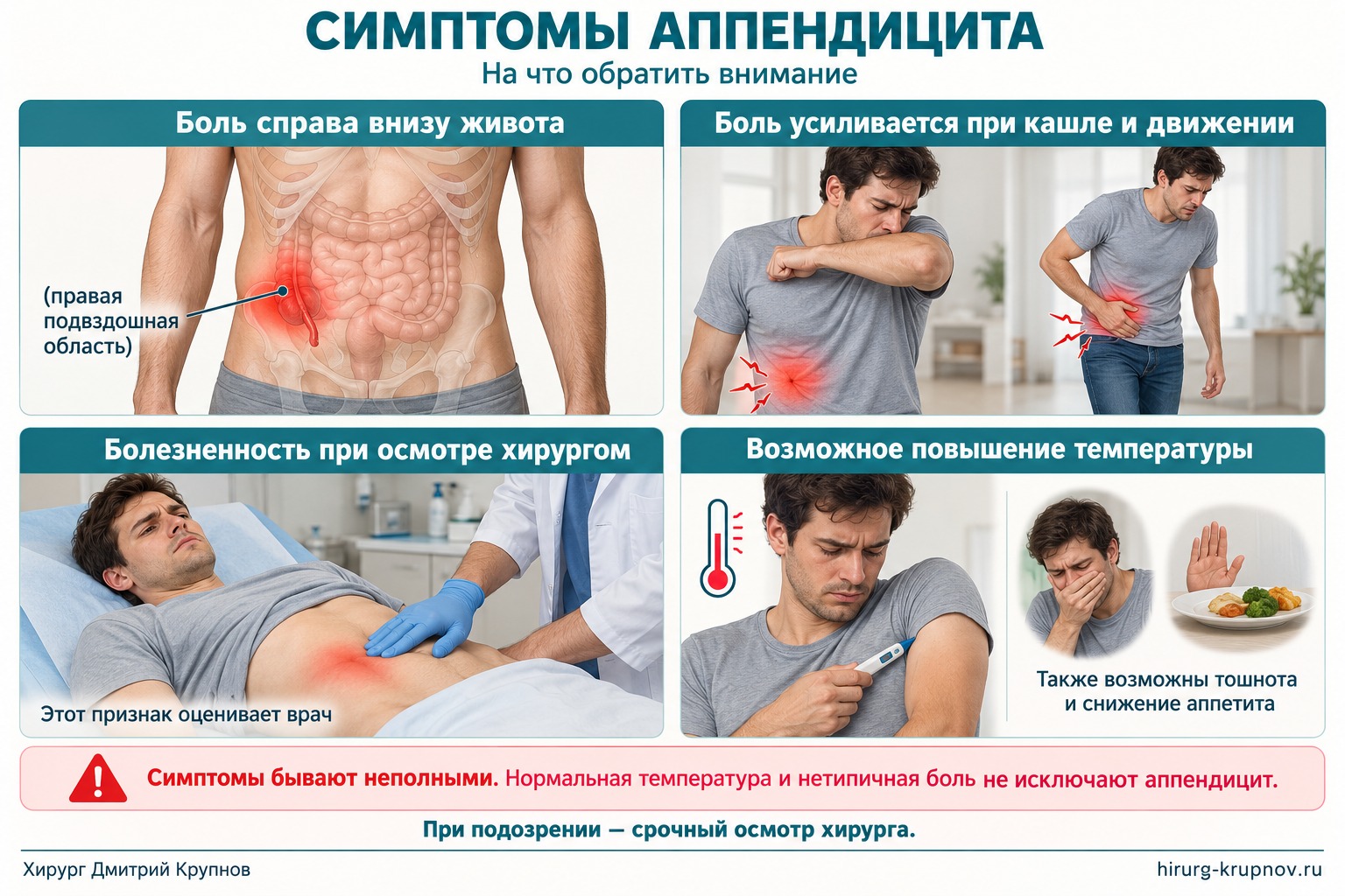 Симптомы аппендицита: боль справа внизу живота, усиление при кашле и движении, болезненность при осмотре хирургом и возможное повышение температуры